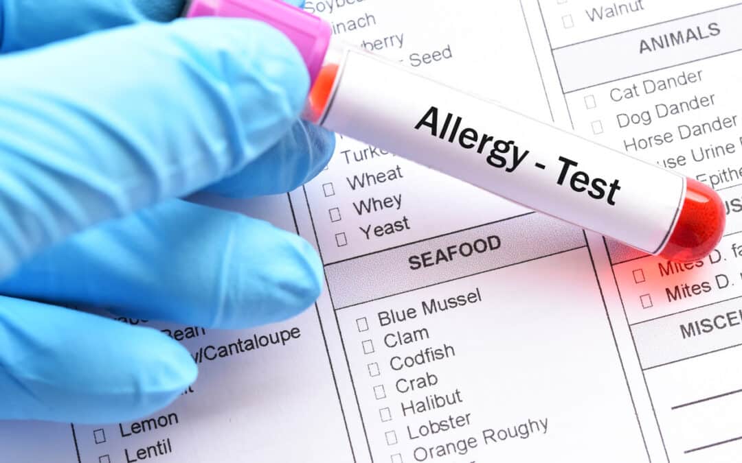 Food Allergy Panels vs. Food Allergy Testing: What You Need to Know