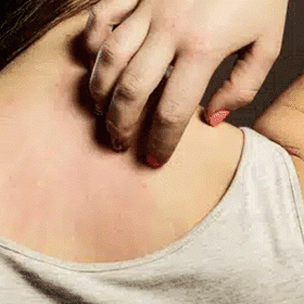 Treatment-Skin