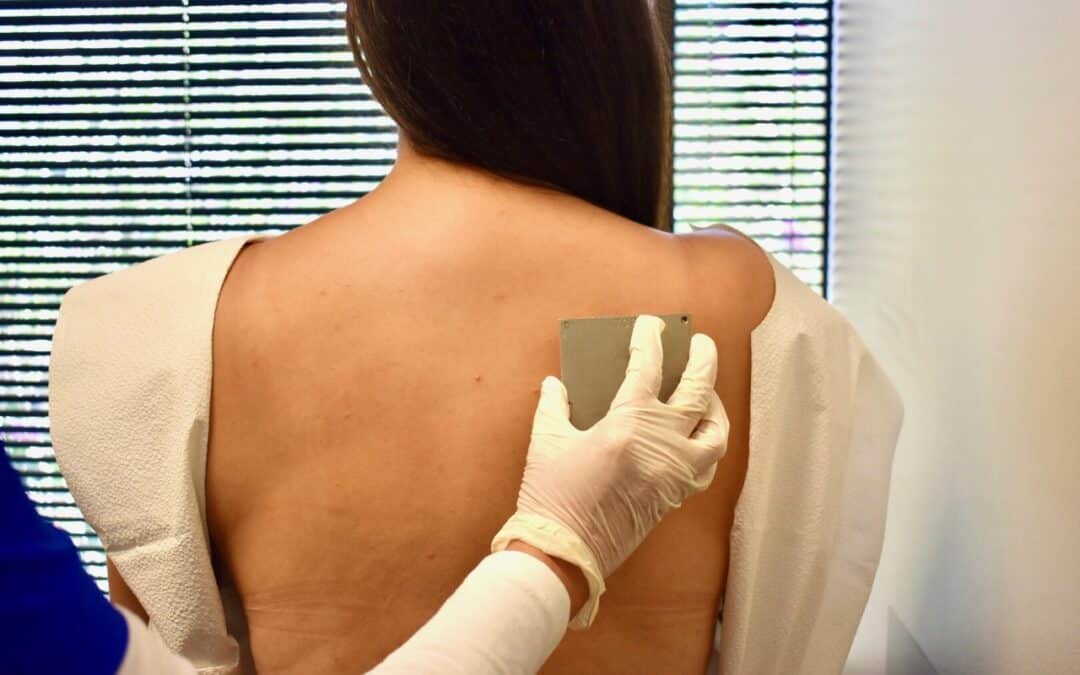 The Ultimate Guide to Allergy Testing in Adults: What to Expect, Prep Tips & Results