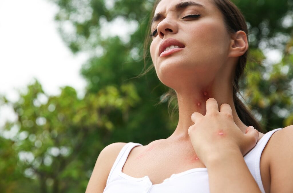Insect Allergy Symptoms